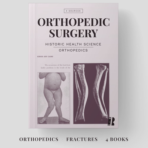 Orthopedic surgery fractures - orthopedic,