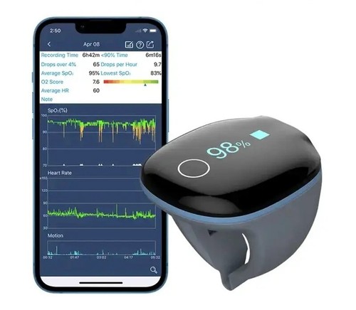 Wellue smart ring - wellue,