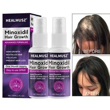 2% Minoxidil per Donna
