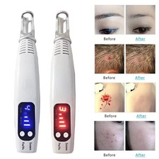Luce laser penna picosecondi - laser,