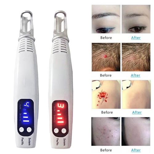Luce laser penna picosecondi - laser,