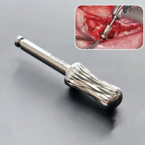 Rimuovi cresta dentale - rimuovi,