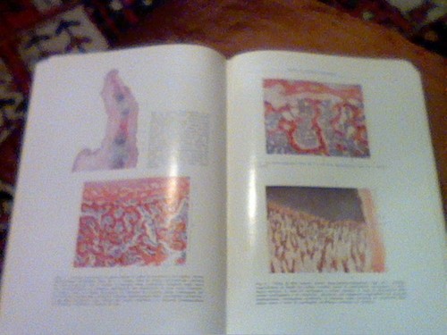 Atlante anatomia - atlante,
