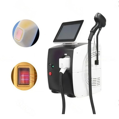 Depilazione laser diodo