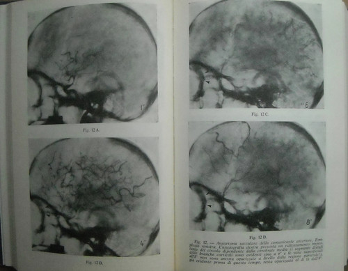 MEDICINA_OCULISTICA_OCCHIO_RET