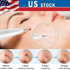 Penna al plasma laser