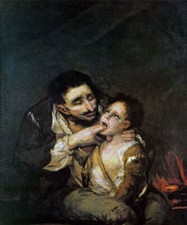 Difterite 1802 epidemia medico - difterite,