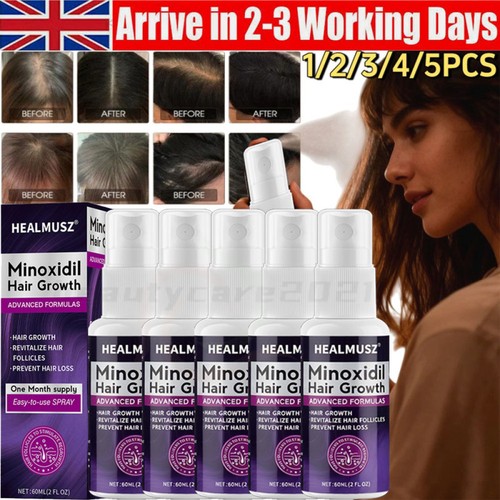 Minoxidil extra forza per - 2%,