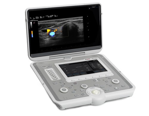 Ultrasuoni esaote mylab sigma - esaote,