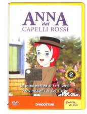 EBOND Anna dai capelli rossi
