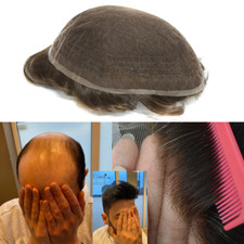 Sistema capelli pizzo francese