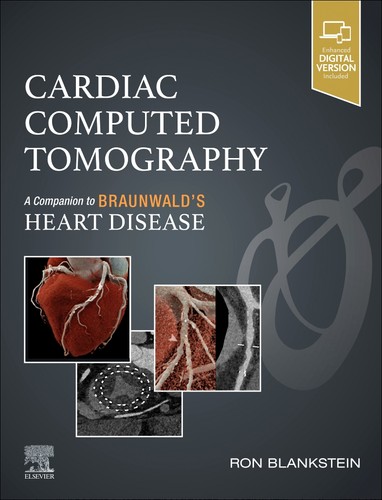 Cardiac computed tomography - computed,