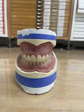 Protesi Dimostrativa Tecnica Gerber Con Denti Candulor Condylator Odontotecnico