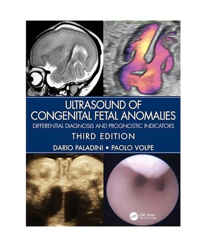 Ultrasound congenital fetal - ultrasound,