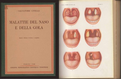 Malattie del naso della gola - del,