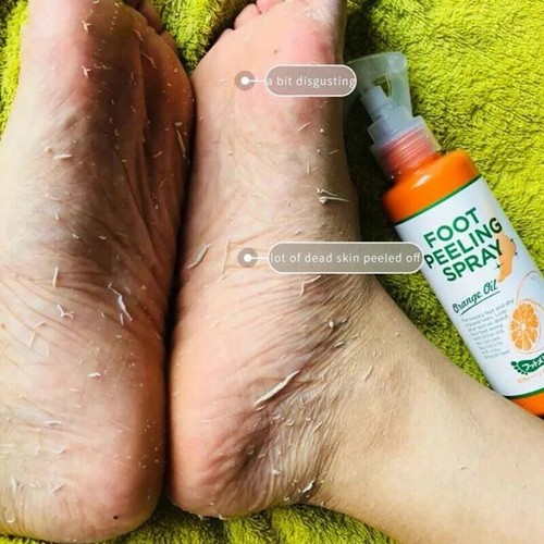Esfoliante piedi 110ml rimuove - 110ml,