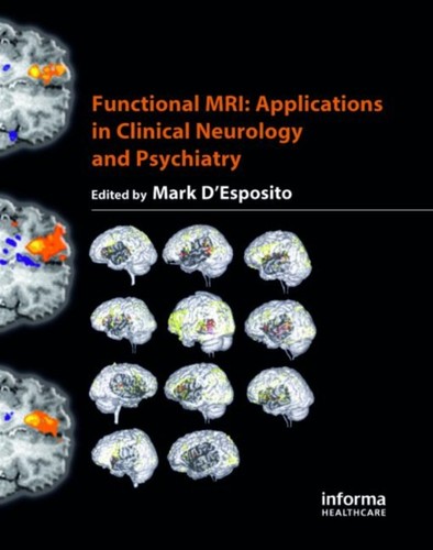 Functional mri esposito - mri, d'esposito