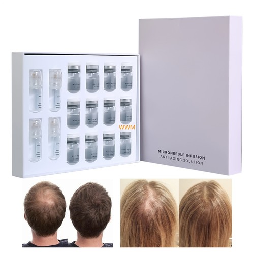 Glov microneedling infuso - microneedling,