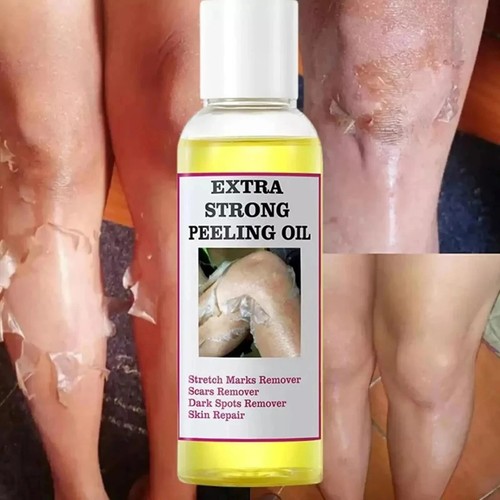 Yellow peeling oil huile - yellow,