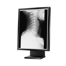 NEC MD21GS-2MP Monitor LCD TFT