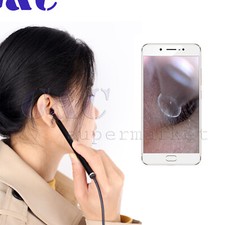 Endoscopio auricolare USB