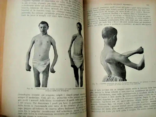 Medicina neurologia strumpell - neurologia,