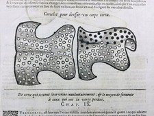 Protesi Ginecologica 1614