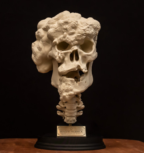 Joseph merrick skull replica - merrick,