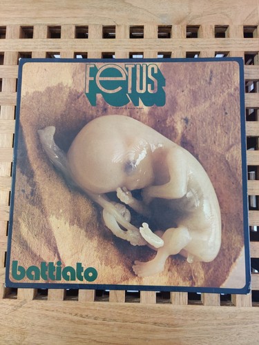 Battiato fetus 1972 prima - battiato, "fetus"
