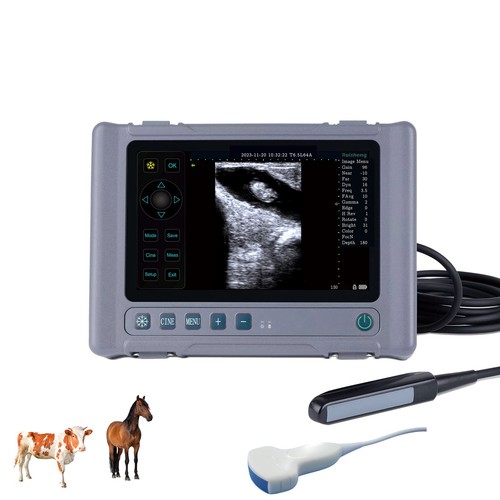 Ultrasuoni diagnostici