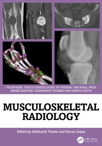 Musculoskeletal radiology - musculoskeletal,