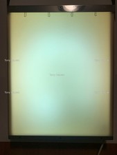 Negativoscopio da Parete Retroilluminato per visualizzare immagini radiografiche