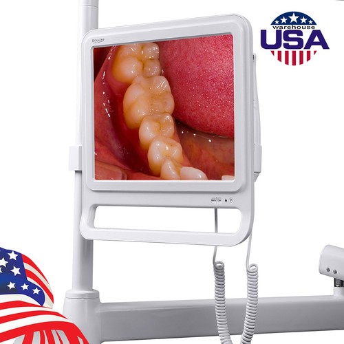 Telecamera intraorale dentale