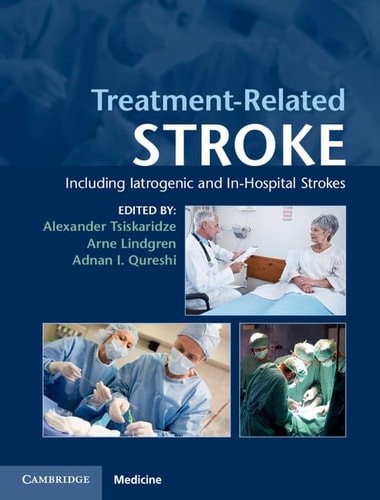 Treatment related stroke - treatment-related,