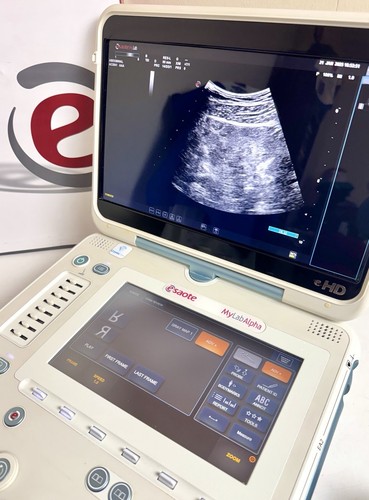 Esaote mylab alpha ehd - esaote,