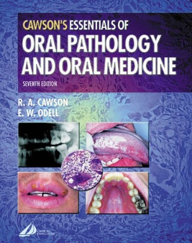 Essentials oral pathology - of,