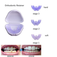 Trainer ortodonzia dentale