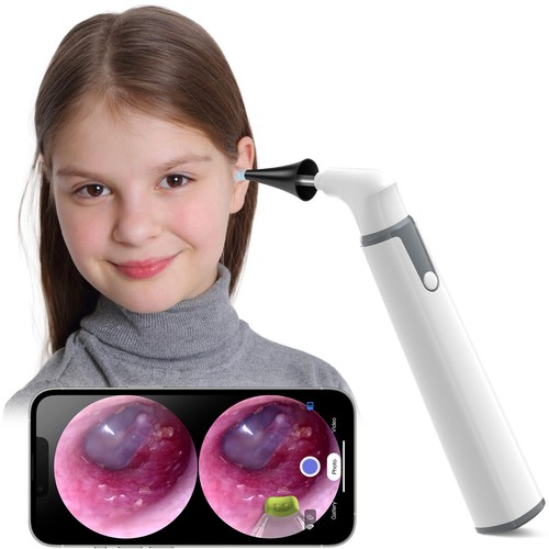 Scopearound otoscopio con - scopearound,