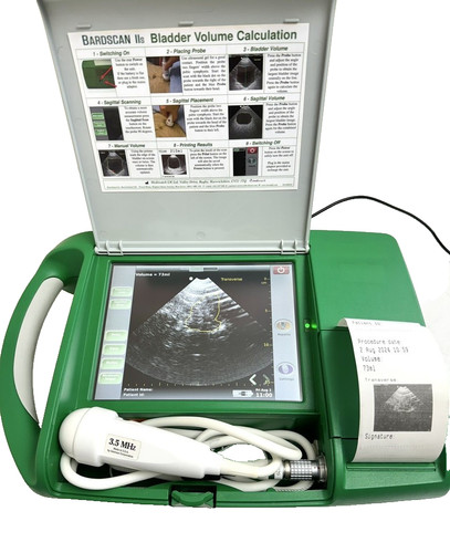 Bardscan iis scanner vescica - bardscan,