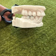 Impressione dentistica vera -