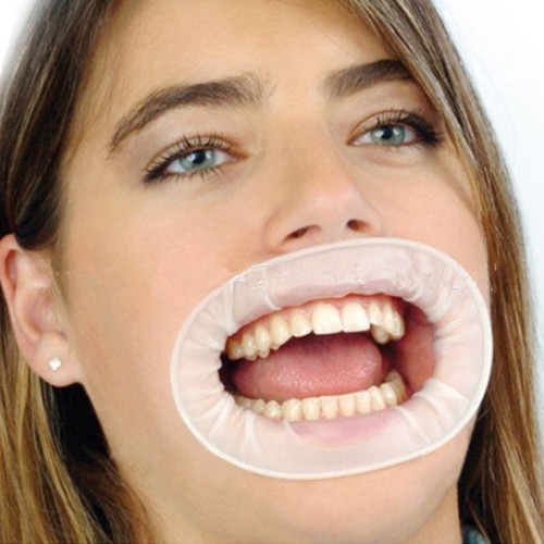 10pz apribocca gomma - 10pz,
