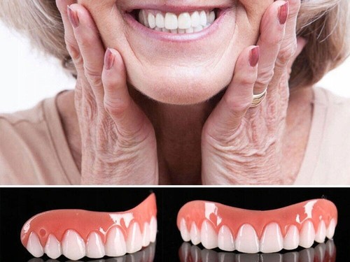 Protesi dentale perfect smile - protesi,
