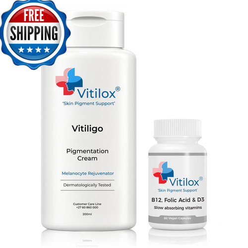 Vitilox vitiligine crema - vitiligine,