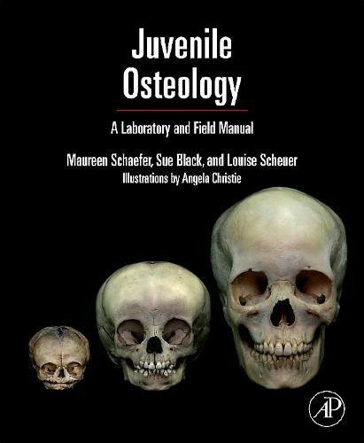 Juvenile osteology a - osteology:,