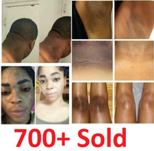 Crema Sbiancante Pelle Scura