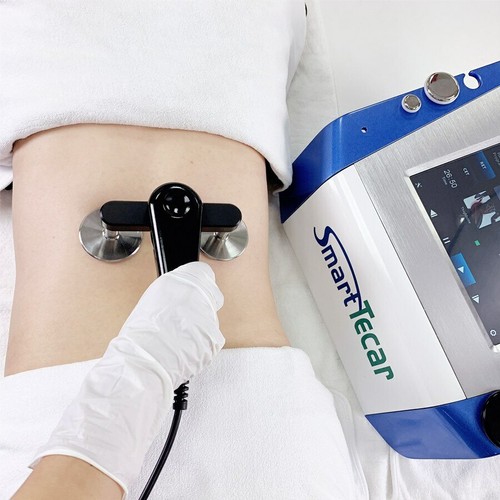 Smart tecar beauty - beauty, cet