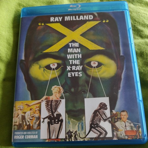 The man with - x:, x-ray