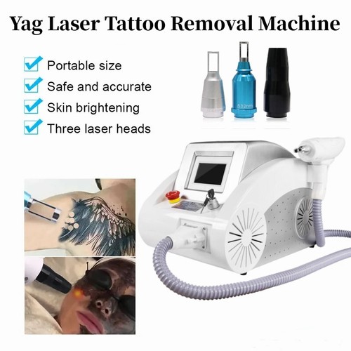 Macchina rimozione tatuaggi