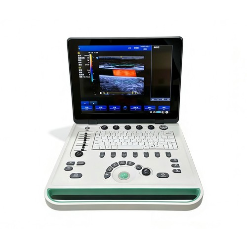 Macchina scanner ultrasuoni