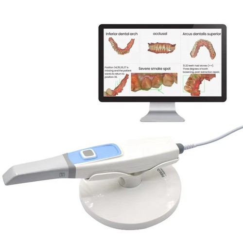 Scanner brillante - scanner, 3d
